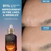 Advanced Night Repair Serum Synchronized Multi-Recovery Complex Recenze